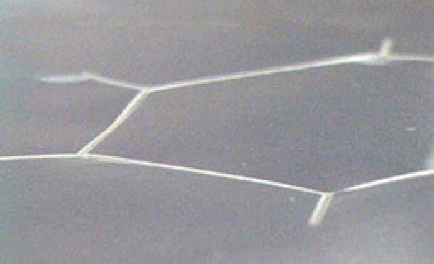 Incision au laser de formes libres - ici ouverture fonctionnelle 